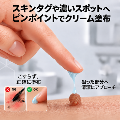 𝐇𝐞𝐚𝐥𝐫𝐢𝐳𝐞® 🥝🩵 肌のイボや気になる色素沈着を7日間集中ケア（やさしい処方で痛みなし・跡が残りにくい）🌿