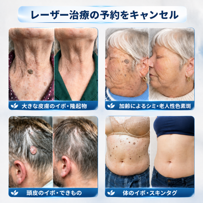 ✨薬剤師もおすすめ 𝑯𝗲𝙖𝐥𝒓𝗶𝙯𝗲® 7日間 タグ＆スポットイレーサー🪄 （痛みゼロ・傷あとゼロを目指すローラーボールタイプ）👩‍⚕️