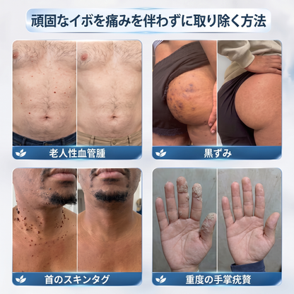 ✨薬剤師もおすすめ 𝑯𝗲𝙖𝐥𝒓𝗶𝙯𝗲® 7日間 タグ＆スポットイレーサー🪄 （痛みゼロ・傷あとゼロを目指すローラーボールタイプ）👩‍⚕️